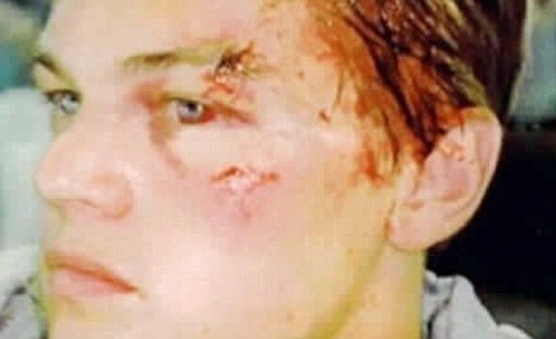 विल्सन द्वारा हमला किए जाने के बाद लियोनार्डो डिकैप्रियो का घायल चेहरा